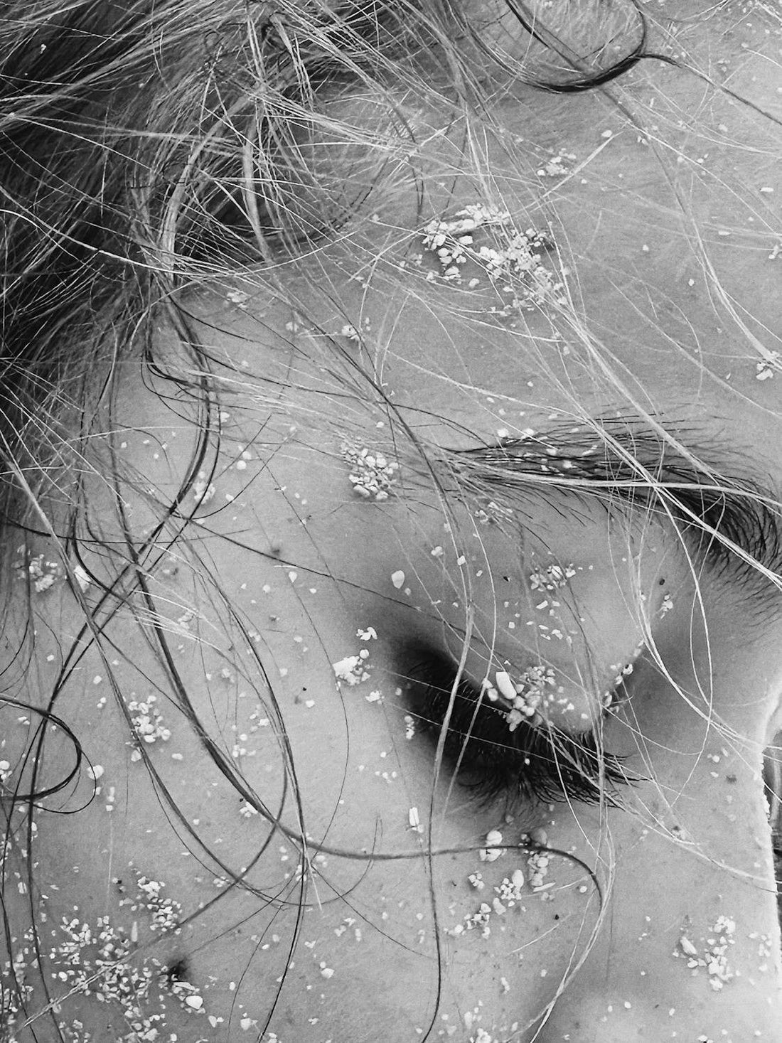 The Truth About Dandruff