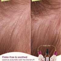 Coconut & Tea Tree Scalp & Hair Oil Travel Size - 50ml