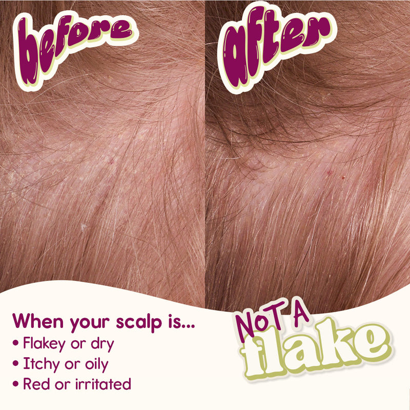 Transformational, yet Natural.