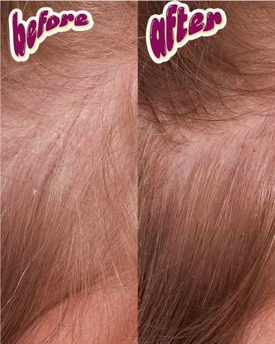 Dandruff Complex  - Clarifying Salt-Free Shampoo